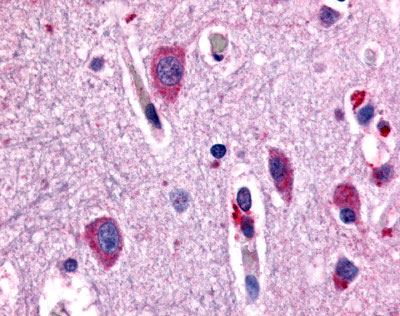 IHC - CHRM2 / M2 Antibody (Cytoplasmic Domain) ALS10336